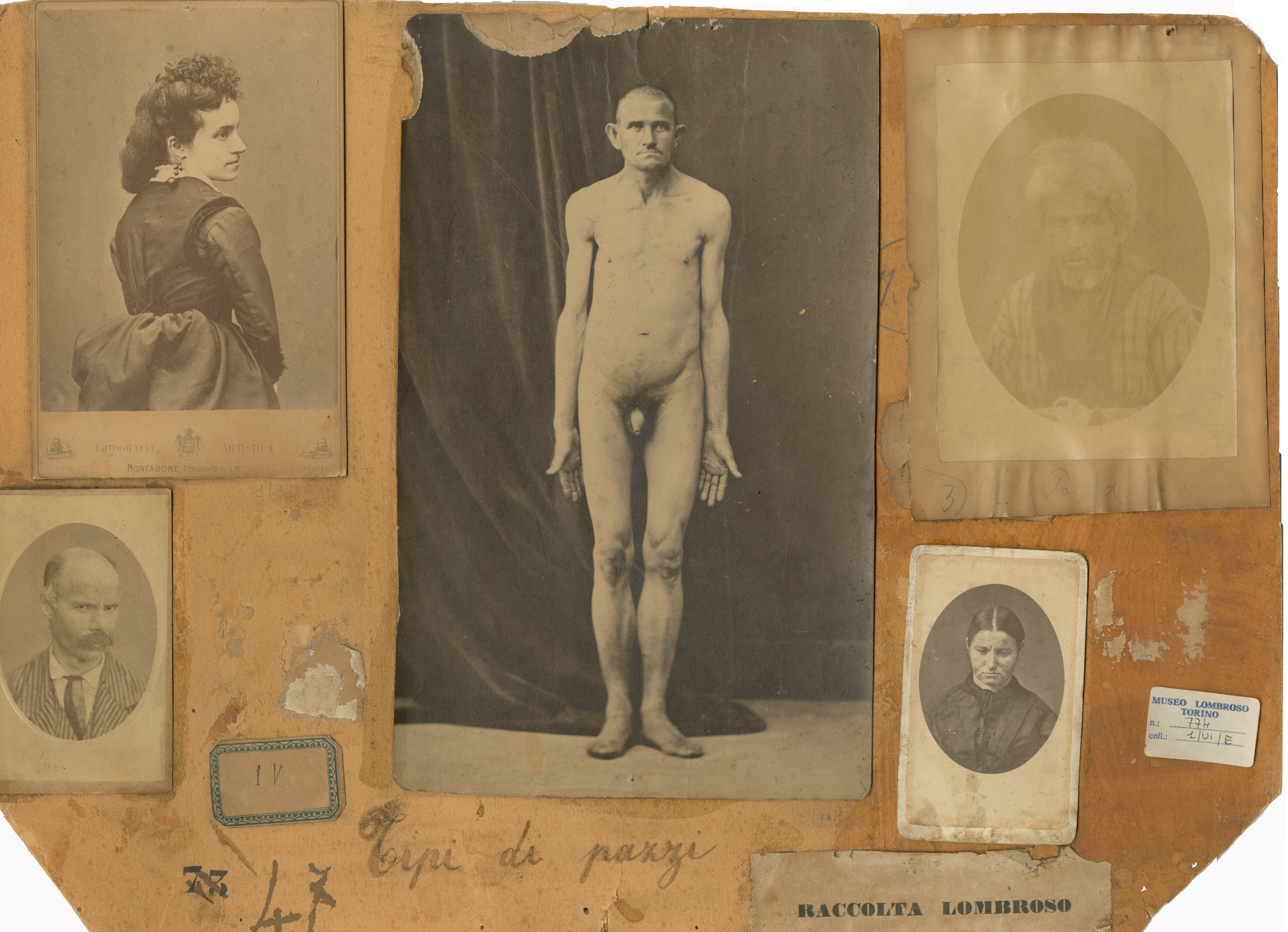 Malades psychiatriques, no 3, 774, Typologie de fous Malades psychiatriques, no 3, 774, Typologie de fous